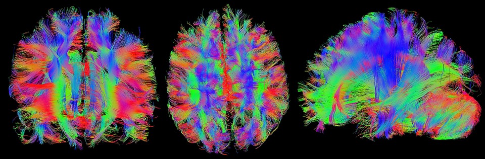Abbildung eines Gehirns mit Hilfe der Magnetresonanztomographie